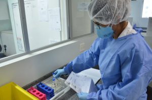 coronavirus_teste_lacen