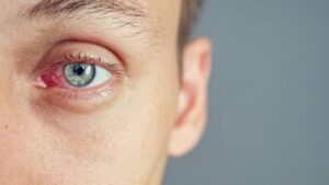 olhos